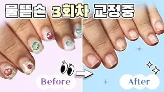 [물어뜯는 손톱] 역대급 아주 천천히 자라나오는 네일바디.. (힘을줘라)