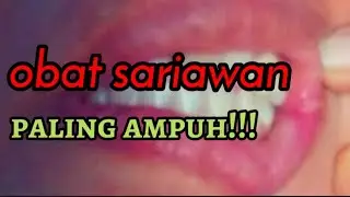 cara mengobati sariawan paling ampuh