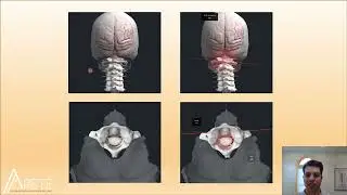 Concussion & Whiplash • Upper Cervical Chiropractic Care