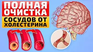 Только эти продукты помогли снизить ХОЛЕСТЕРИН. Народная медицина лучше любых таблеток!