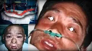 LA MUERTE MÁS DOLOROSA Y TERRIBLE DE TODA LA HISTORIA | 83 días en el infierno: Hisashi Ouchi
