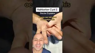 Hairbarber Cyst!💈 #shorts