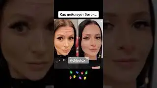 Как действует ботокс.