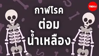 อดีต ปัจจุบัน และอนาคตของกาฬโรคต่อมน้ำเหลือง - ชารอน เอ็น. เดวิตต์