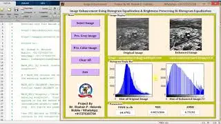 Matlab Code for Image Enhancement using Histogram Equalization