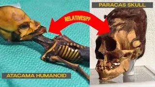 The Paracas Skulls: Ancient Enigma Unveiled #paracas
