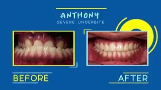 Custom Content Example: Orthodontic Before & After
