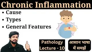 Chronic Inflammation in Hindi || Types, Cause, General Features || Pathology Lecture Notes