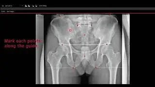 Vieworks QXLink 3 Chiropractic Measurement Tools
