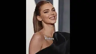 Kendall Jenner Surgeries 🤍🎀 #2022 #celebrity #models #plasticsurgery #kendalljenner
