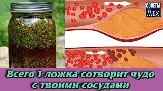 Как почистить сосуды, чтобы не было бляшек и избавиться от атеросклероза