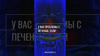 Проблемы с печенью. Симптомы #печень #здоровье #симптомы #боль
