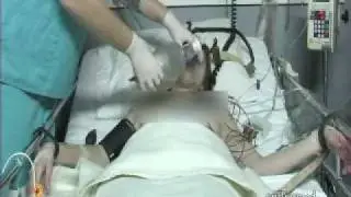 ECT remedy 2