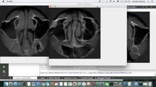 dcm dicom images qt + opencv +gsdcm