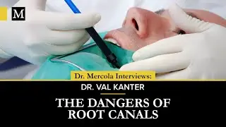 Root Canal Dangers — Interview with Dr. Val Kanter