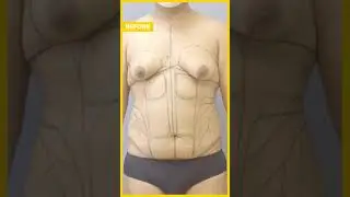 Transgender 360° Transformation Care Before & After Results 
