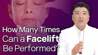 How Many Times Can a Facelift Be Performed? Learn About the Limitations of Full Facelifts