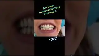 Stomatoloq Eldeniz
