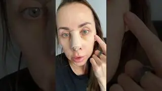История моей ринопластики. 