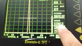 Difference Between Einstein II TFT & Einstein II DGS