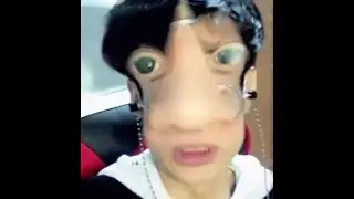 What happened to my plastic surgery