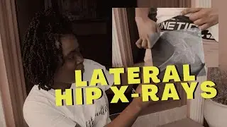 Lateral Hip X-ray Positioning & Centering Tips w/ Demo || Ask The Rad Tech