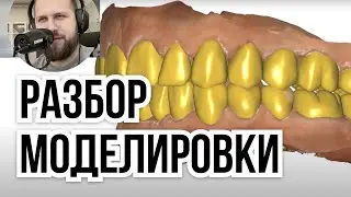 EXOCAD modelling проверка работ зубного техника. Обучение EXOCAD зубной техник обучени е моделир