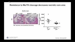 Atherosclerosis and non-alcoholic steatohepatitis