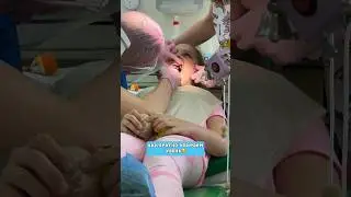 УДАЛЕНИЕ ЗУБА🦷 