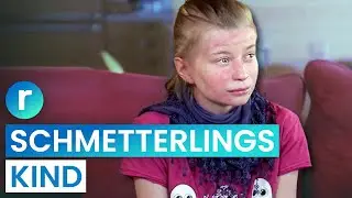 My skin is as sensitive as a butterfly's wing | Part 1