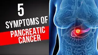 5 warning signs of Pancreatic Cancer you should NEVER ignore