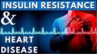 Can you develop Heart Disease if you're not Insulin Resistant? | Dr. William Cromwell