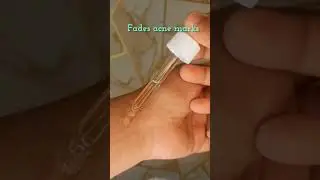 @dermatouch.official sebustop serum
