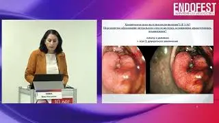 Секция Амбулаторная эндоскопия ЭндоФест 2023