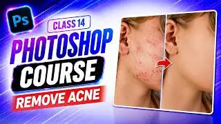 How to Use Spot Healing Brush to Remove Pimples, Acne and Blemishes in Photoshop - Urdu / Hindi