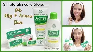 3 Simple Steps to get rid of Acnes