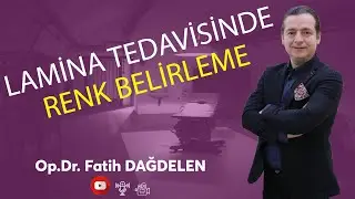 Lamina Tedavisinde Rengi Belirleyebiliyor Muyuz?