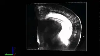 3D rendering of fluorescence images taken using SeeDB and a two-photon laser scanning microscope