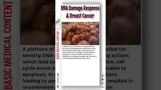 DNA Damage Response & Breast Cancer