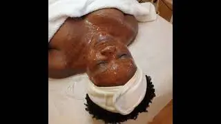 How To Really Care For Black Skin After a Facial