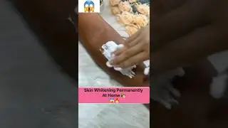 Skin Whitening Permanently at Home #viral #beauty #whiteningremedy