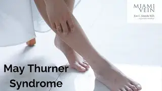 May-Thurner Syndrome Causes, Symptoms & Treatment Guide