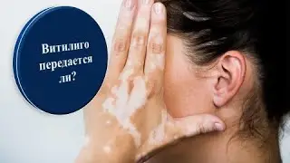 Лечение Витилиго  продуктами LR