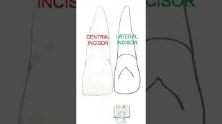 Identification of Maxillary Lateral Incisor 