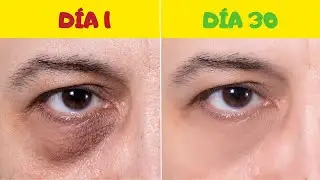 Descubre COMO QUITAR las BOLSAS de los OJOS Sin Cirugía