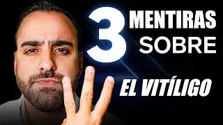 ¡No Te Dejes ENGAÑAR!  3 Grandes MENTIRAS sobre el VITÍLIGO