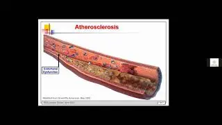Cardiovascular Effects of Alcohol and Organ Damage