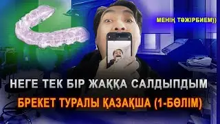 Неліктен брекетті тек бір жағына салдым, брекет туралы менің тәжірбием, қазакша (1 бөлім) #брекет