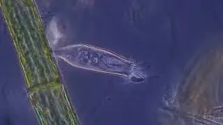 Peritrich ciliate, Scyphidia rugosa