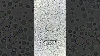 Raw Cows Milk VS Human Breast Milk under the microscope!